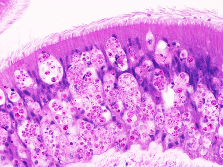 40 times magnified section of the same tissue slide