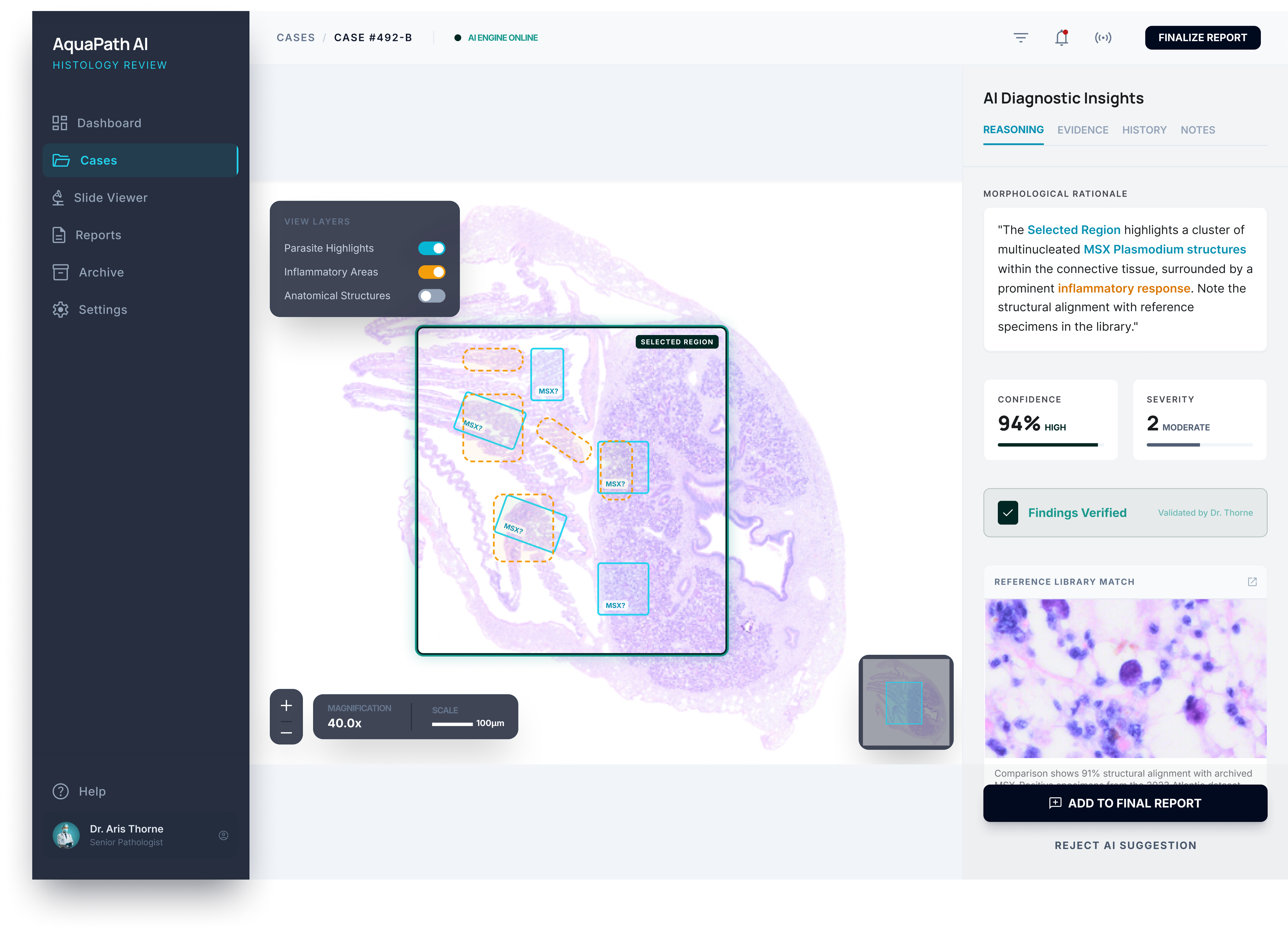 Product screenshot of the AquaPath AI review interface — concept UI, in active development